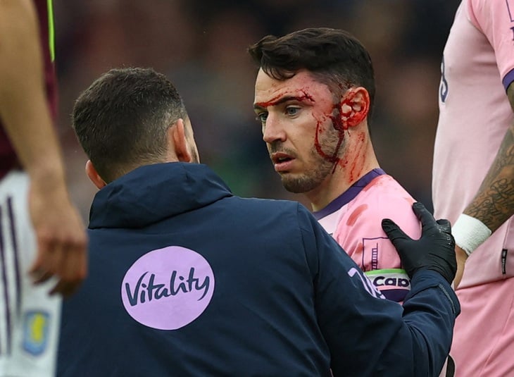 Hậu vệ Ngoại hạng Anh va chạm kinh hoàng với đồng đội - Ảnh 1.