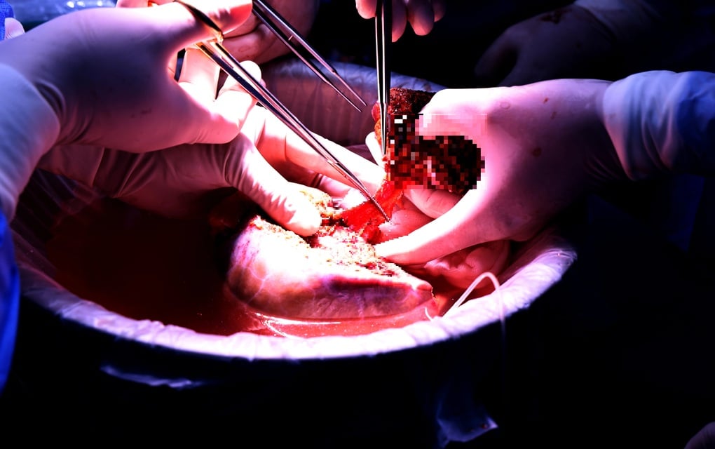 El regalo del soldado a este mundo revivió 6 vidas - 2