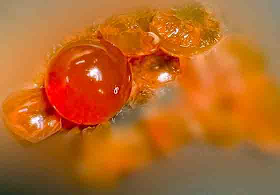 Tắc ruột do hạt nở  - Ảnh 1.