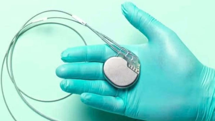 nhịp tim - Ảnh 1.