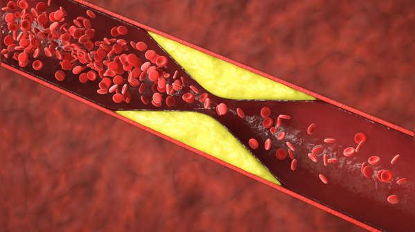 5 loại trà thảo mộc giúp hạ cholesterol, bảo vệ tim mạch- Ảnh 1.