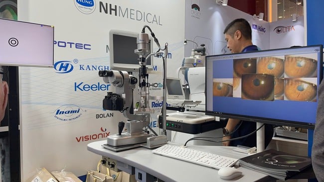 Associação Oftalmológica do Vietnã pioneira na aplicação de tecnologia à expertise - Foto 3. Hội nhãn khoa Việt Nam tiên phong ứng dụng công nghệ vào chuyên môn- Ảnh 3.