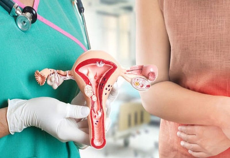 Những nguyên nhân phổ biến khiến phụ nữ mắc viêm cổ tử cung- Ảnh 2.