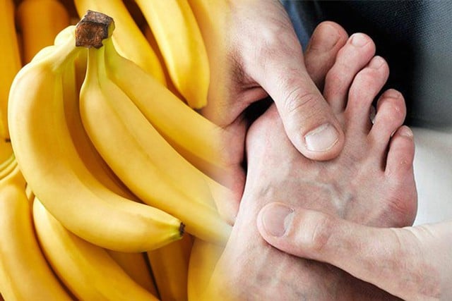 5 loại trái cây hỗ trợ kiểm soát nồng độ axit uric cao- Ảnh 2.