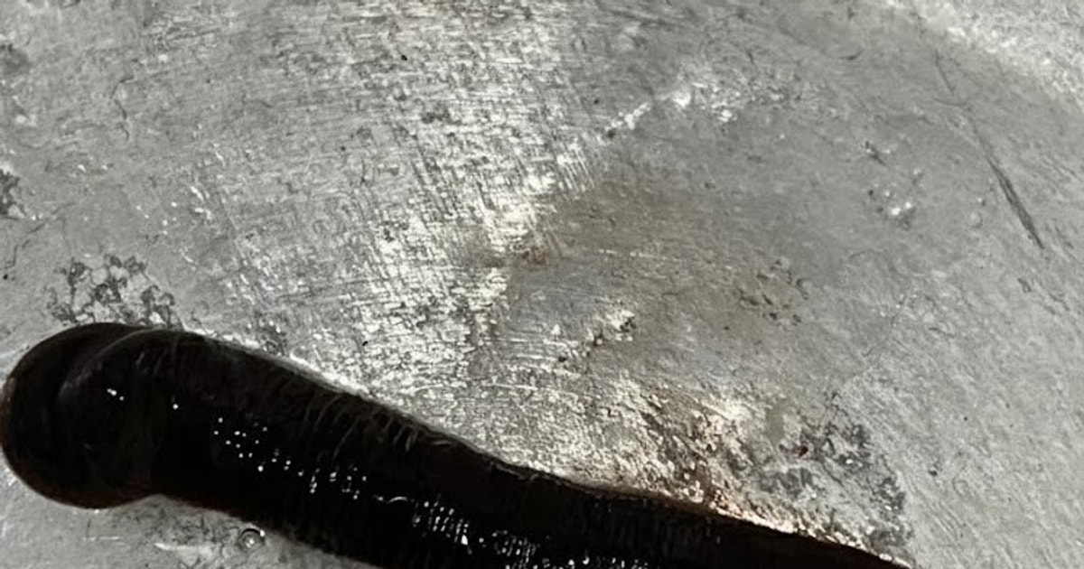 Gắp thành công con vắt dài 6cm trong mũi bệnh nhân