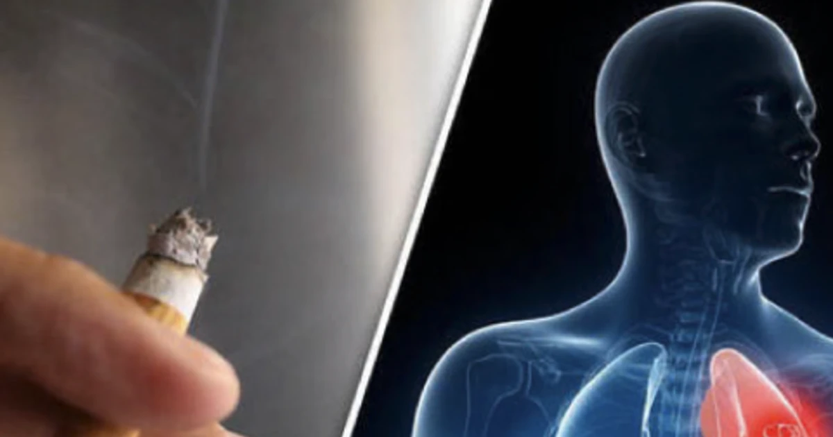 9 ca ung thư phổi đầu tiên từ nghiên cứu mới ở Singapore đều là người không hút thuốc