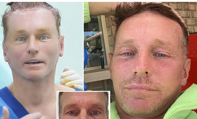 Người đàn ông Úc 'nổi như cồn' sau khi đến Việt Nam phẫu thuật thẩm mỹ