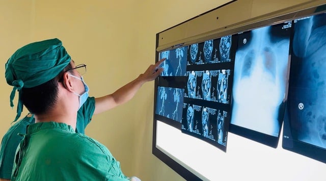 Khám sức khỏe tổng quát, bác sĩ phát hiện khối bướu bất thường ở thận - Ảnh 1.