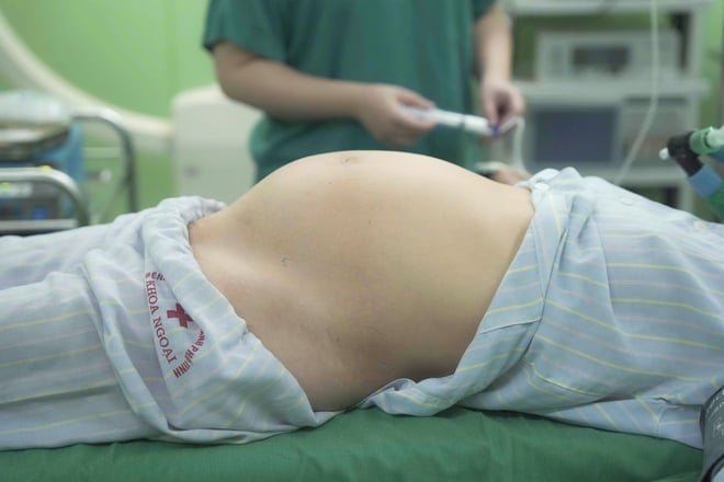 Phẫu thuật khối u nang buồng trứng nặng 6kg cho người phụ nữ 56 tuổi- Ảnh 4.