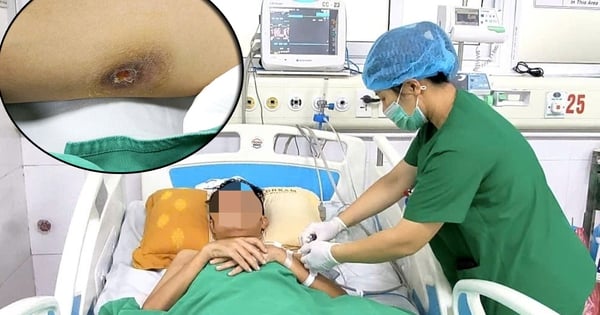 Nam thanh niên mắc Whitmore, áp xe đa tạng