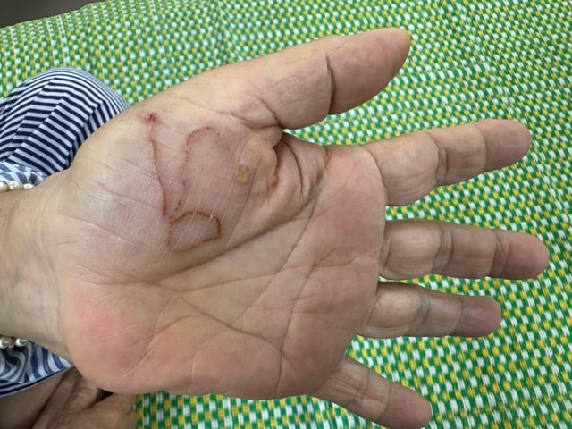 Bị nhiễm ký sinh trùng cần đi khám và điều trị ở đâu?- Ảnh 1.