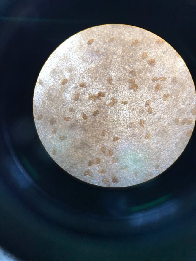 Bị nhiễm ký sinh trùng cần đi khám và điều trị ở đâu?- Ảnh 2.