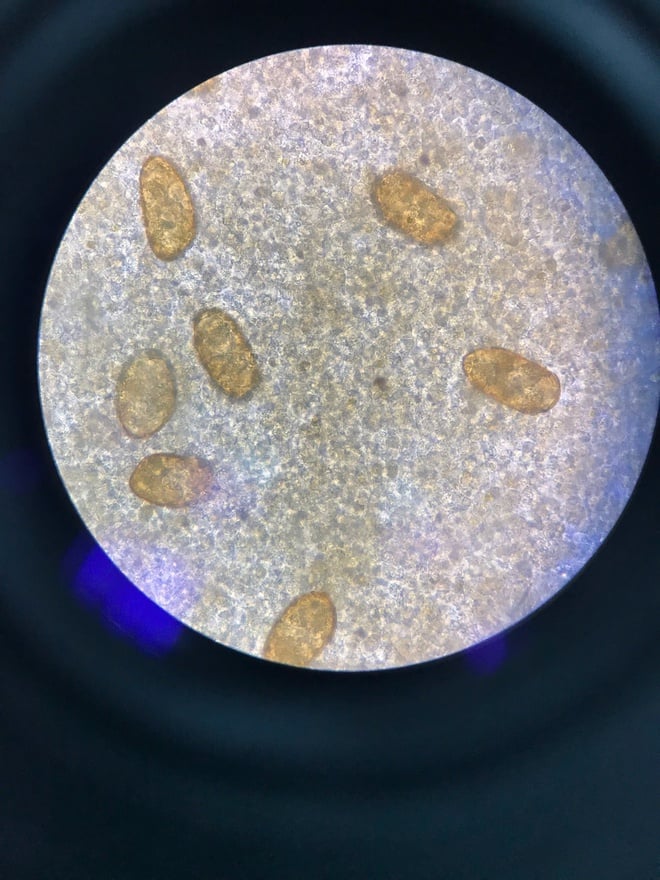 Bị nhiễm ký sinh trùng cần đi khám và điều trị ở đâu?- Ảnh 3.