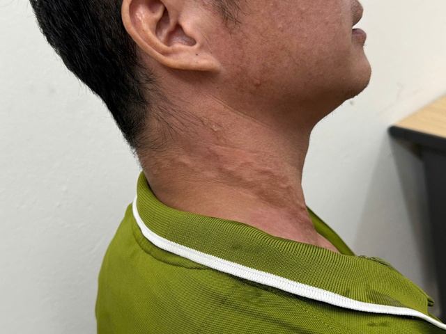   Bệnh ký sinh trùng có nguy cơ bùng phát  - Ảnh 2.