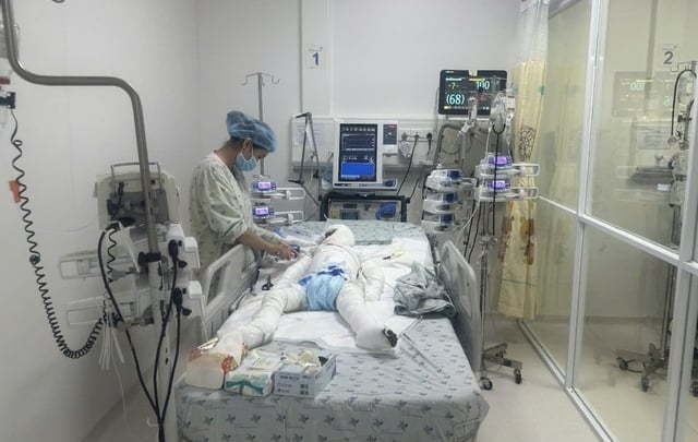 Bé trai ở Tây Ninh bị cha đổ xăng phóng hoả đã khoẻ lại- Ảnh 1.