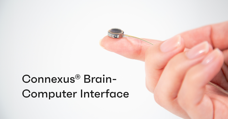 cấy chip - Ảnh 1.