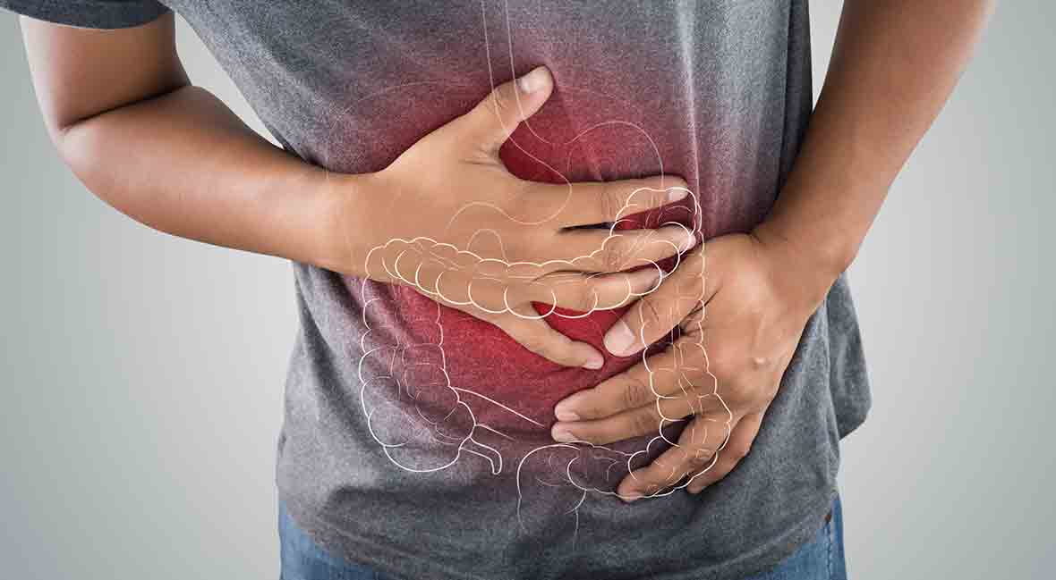 Common signs of ulcerative colitis - Image 2.