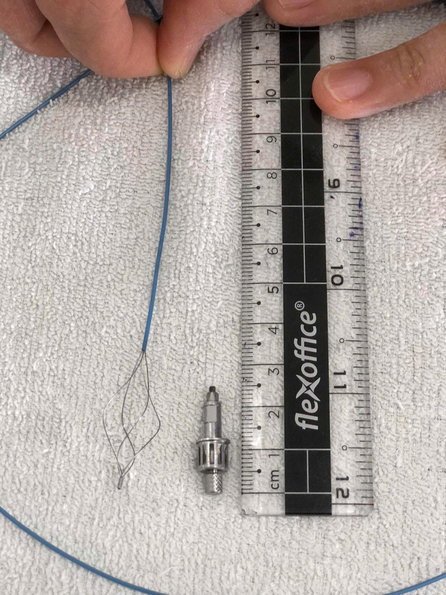 Ho kéo dài sau khi làm răng, người đàn ông phát hiện dụng cụ nha khoa trong phế quản- Ảnh 1.