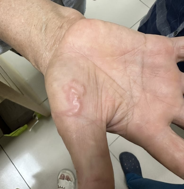 Biểu hiện mắc giun sán cần đi khám sớm, khám ở đâu?- Ảnh 2.