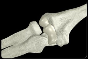 Bước tiến mới của khoa học vật liệu y sinh Việt Nam- Ảnh 2.