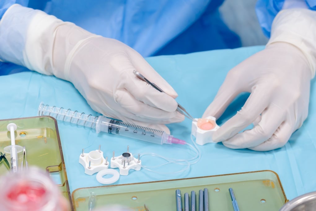 ভিয়েতনামী মহিলা ডাক্তারের আবিষ্কার কর্নিয়া প্রতিস্থাপনে নতুন অগ্রগতি সাধন করেছে - ১