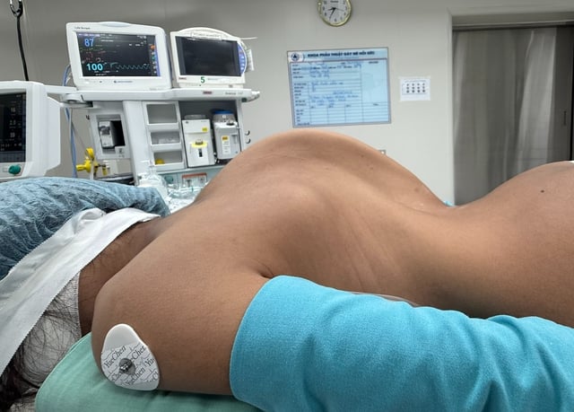 দুই মেয়ের 'ডাইনোসরের মেরুদণ্ড' সোজা করার যাত্রা - ছবি ১। Hành trình nắn lại 'xương sống khủng long' cho hai bé gái- Ảnh 1.