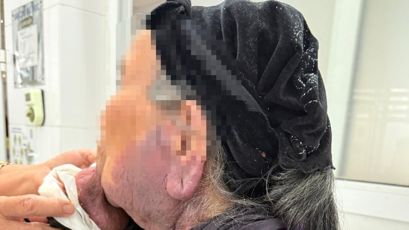 Läkare undersöker patienter före operation