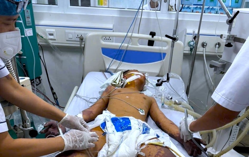 Un calciatore ha dovuto subire l'amputazione di una gamba a causa di una malattia meningococcica - 3