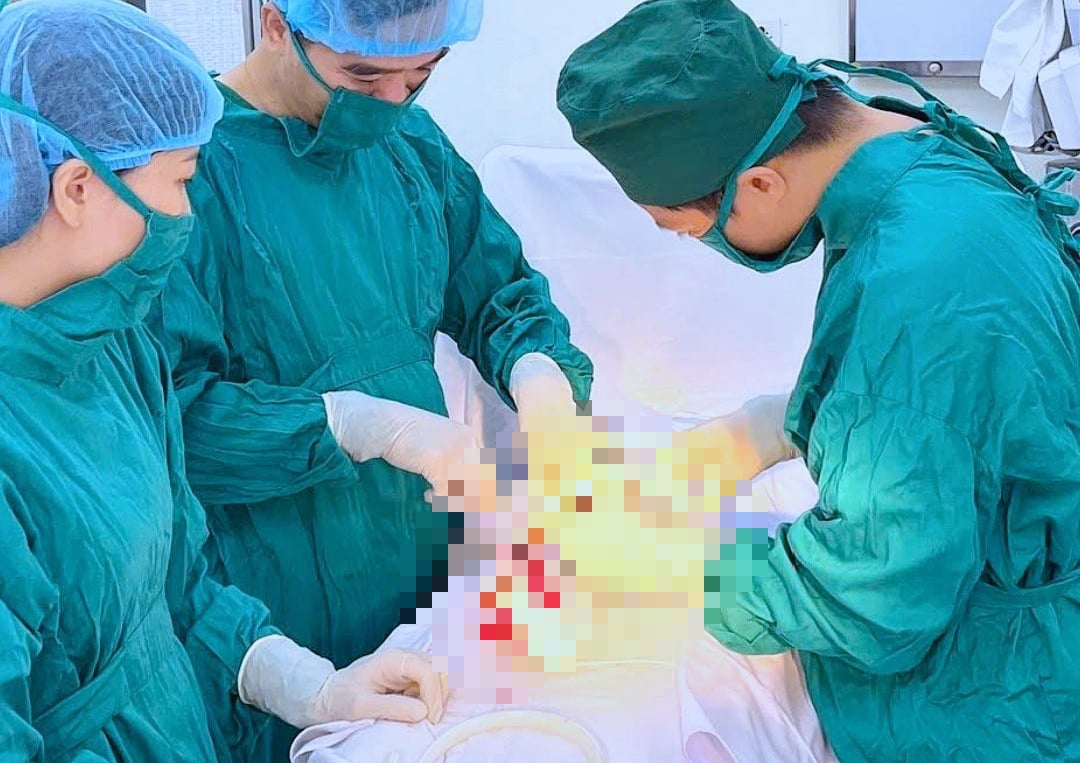 Ca mổ trong đêm khuya cứu sống sản phụ chửa ngoài tử cung vỡ, trụy mạch- Ảnh 1.