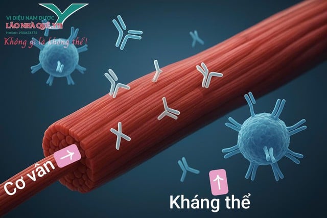 Trị liệu khai thông cột sống – hỗ trợ phục hồi cho bệnh nhân kháng thể tự miễn tiêu cơ vân- Ảnh 1.