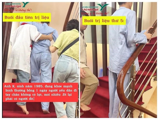 Trị liệu khai thông cột sống – hỗ trợ phục hồi cho bệnh nhân kháng thể tự miễn tiêu cơ vân- Ảnh 3.