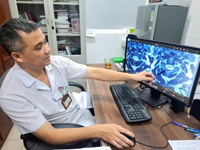 Thiếu nữ 23 tuổi bị liệt dần vì bóng cười, hít 12–15 giờ liền gia đình không hề biết- Ảnh 2.