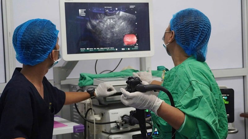 A equipe de endoscopia colocou um stent LAMS no paciente.