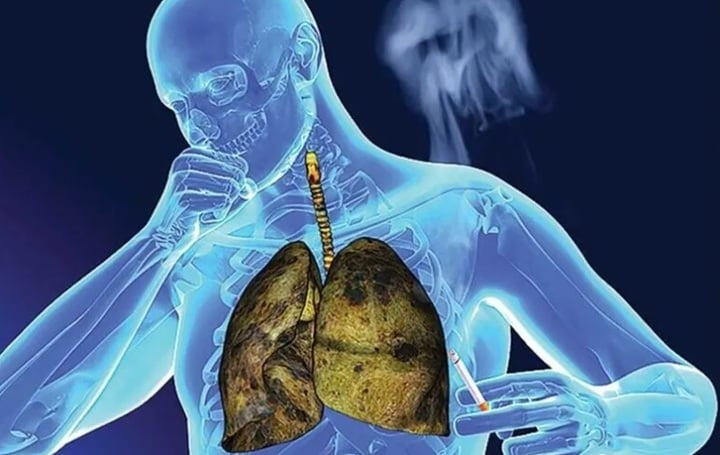 Phát triển thiết bị LoC hỗ trợ phát hiện sớm tế bào ung thư phổi - Ảnh 1.