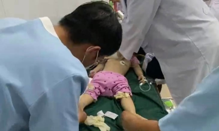 sặc thức ăn  - Ảnh 1.