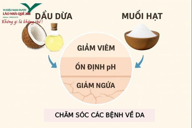 Solution naturelle pour les peaux sèches, gercées et calleuses, utilisant uniquement de l'huile de coco et de l'eau salée tiède - Image 1. Giải pháp tự nhiên cho da khô nứt nẻ chai sần chỉ từ dầu dừa và nước muối ấm- Ảnh 1.