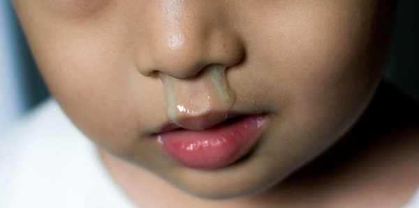Khói bụi, điều hòa quá lạnh hoặc không khí khô đều làm mũi trẻ tăng tiết dịch. Ảnh minh hoạ