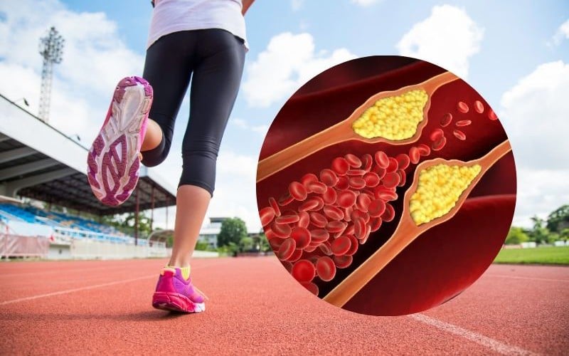 5 bài tập tốt nhất để giảm mỡ máu (cholesterol xấu) một cách tự nhiên- Ảnh 2.