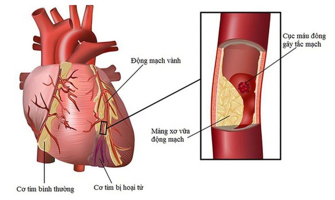Tác dụng và bài thuốc từ vỏ chanh- Ảnh 2.