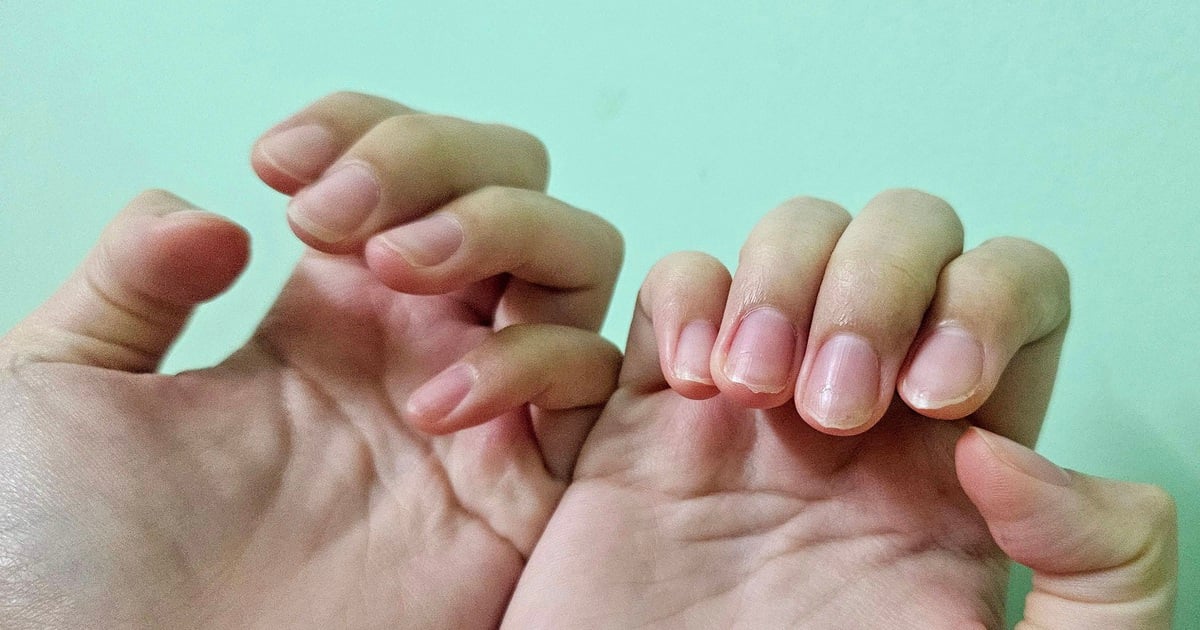 La vérité sur le fait que se ronger les ongles peut provoquer des maladies cardiovasculaires