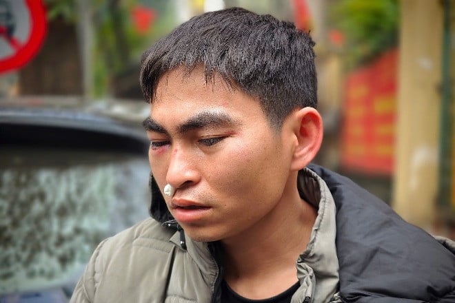 Male shipper assaulted: 'I still have a headache, the police are taking me for examination'