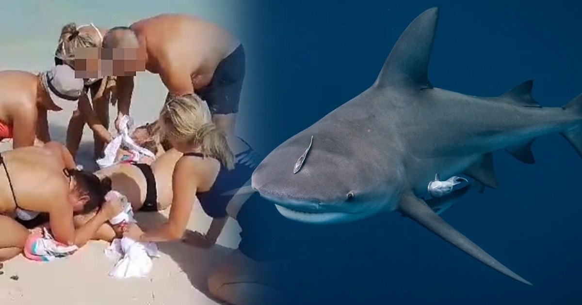 En essayant de prendre un selfie avec un requin, une touriste a perdu ses deux bras