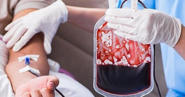 The truth about the method of "blood filtration to help eliminate diseases"?