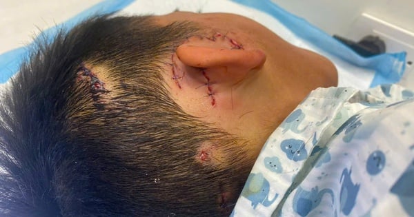 An 8-year-old boy almost lost his right ear after being bitten by his family dog.