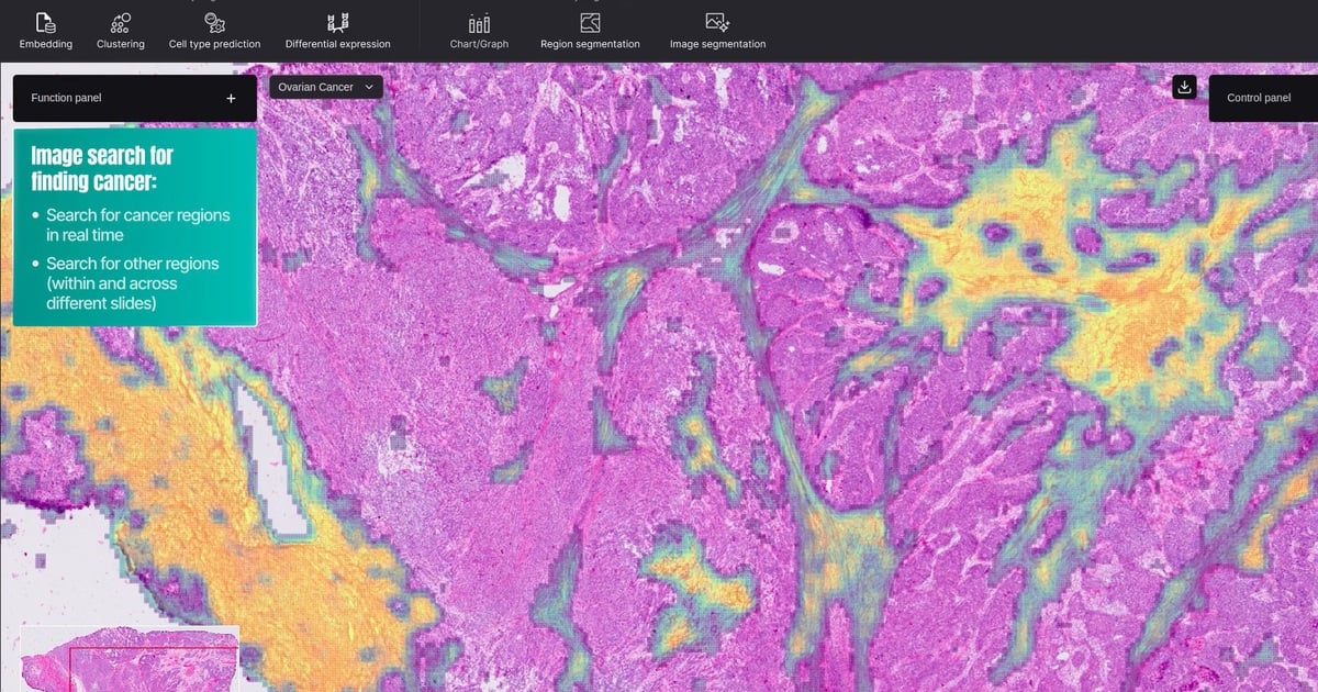 Launch of AI model to track cancer tumors at the cellular level