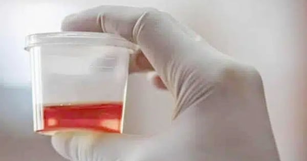 Is blood in urine dangerous?