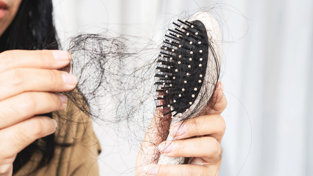 Secrets to treating hair loss with easy-to-find ingredients