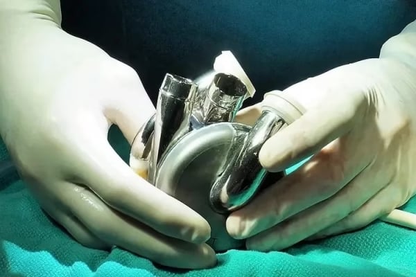 World's first patient discharged from hospital and survived 100 days with artificial heart made of titanium