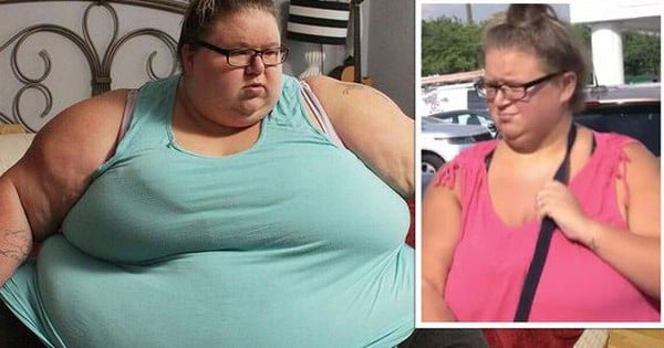 The unbelievable current life after losing weight of a woman weighing 357 kg, so fat that she faces the risk of being bedridden for life