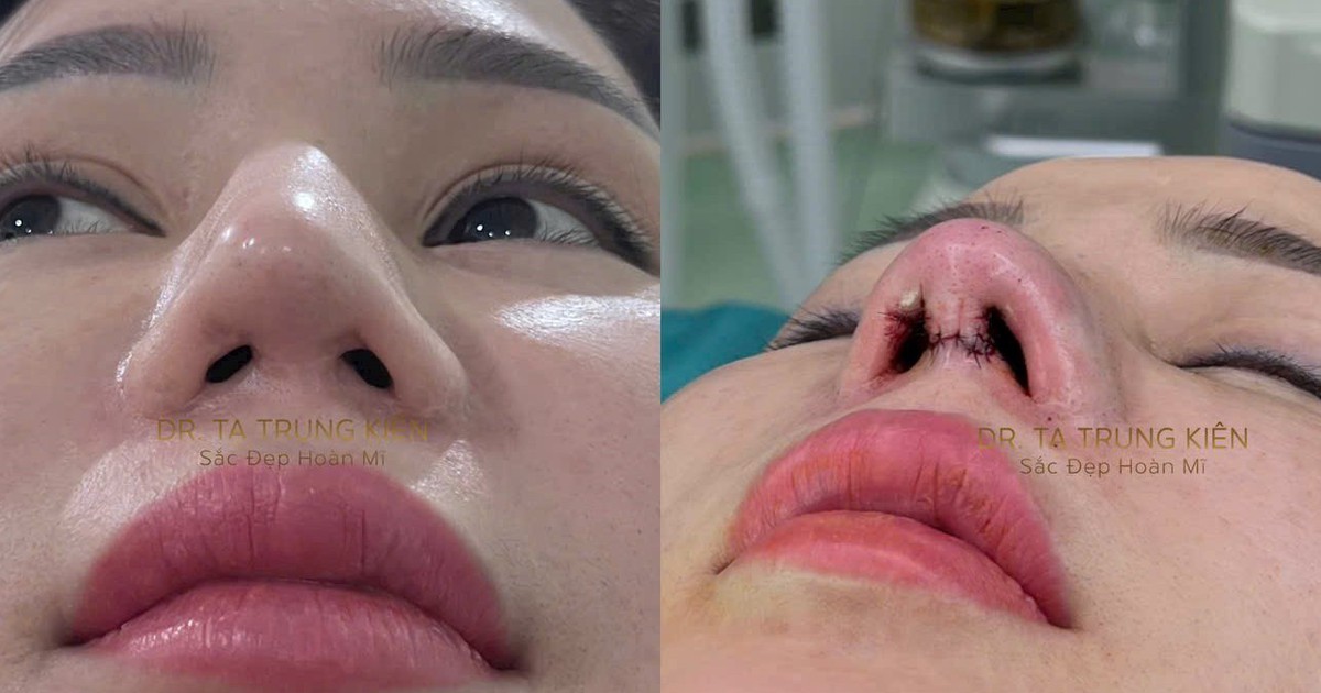 El doctor CK1 Ta Trung Kien comparte la solución para 'optimizar la belleza' en la estética